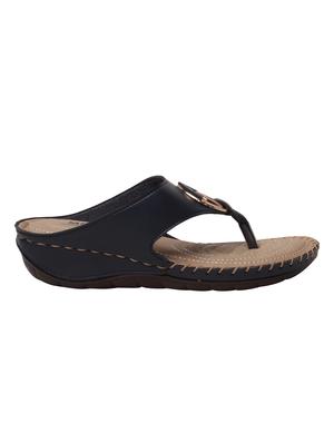 black toe separator wedges - 15861562 - Standard Image - 2