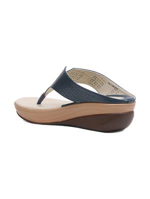 blue toe separator wedges - 16092461 - Standard Image - 3