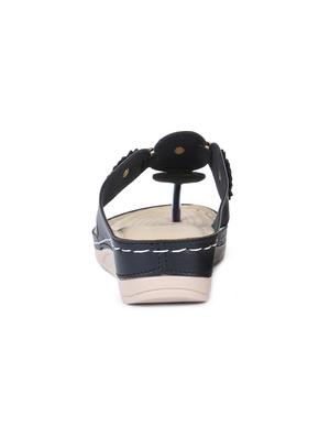 black toe separator sandals - 16893706 - Standard Image - 3