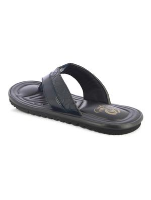 navy toe separator slippers - 17076768 - Standard Image - 3