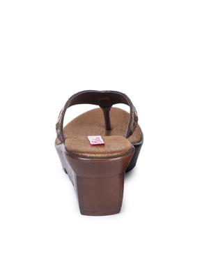 copper toe separator wedges - 17377049 - Standard Image - 3