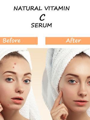 swosh vitamin c serum is most - 18180336 - Standard Image - 2